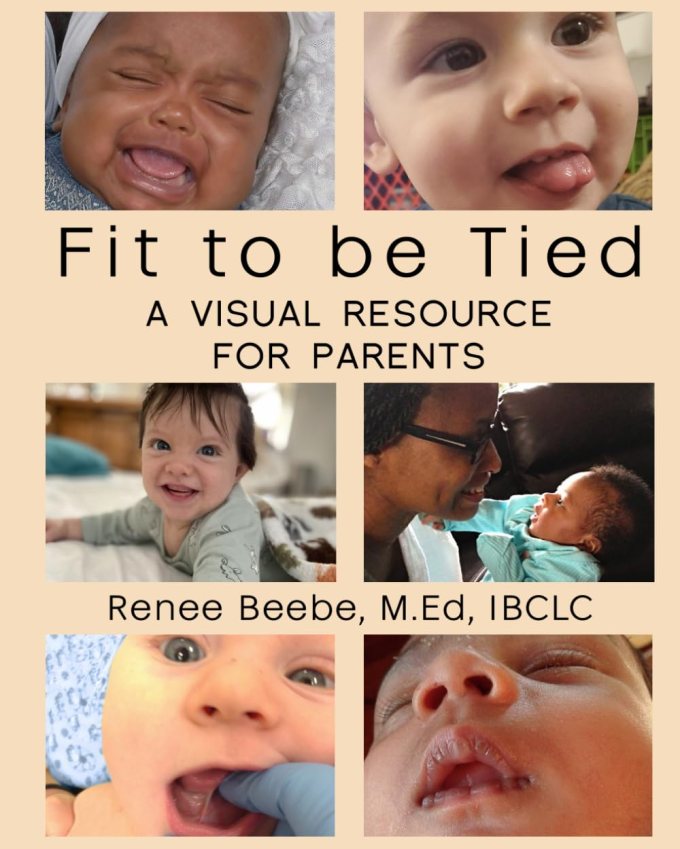 Fit to be Tied: A Visual Resource for Parents tongue tied infants book cover image on Amazon